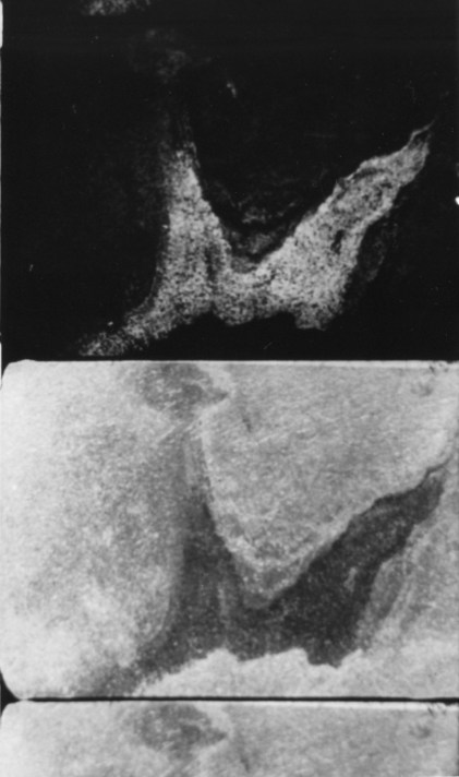 4:61 mauern-positiv-negativ und weg